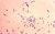 171210-kompas-id-bakteri-C-diphtheria-720×450