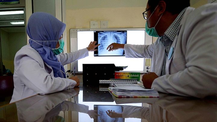 Rontgen Kanker Paru - Petugas medis menganalisa rontgen kanker paru pasien yang menjalani perawatan di Klinik Paru RSUP Persahabatan Jakarta, Jumat (3/3). Sebanyak 90 persen pasien dengan kanker paru memiliki riwayat sebagai perokok.

Kompas/Wawan H Prabowo (WAK)
03-03-2017

Untuk Liputan Tematis Tembakau